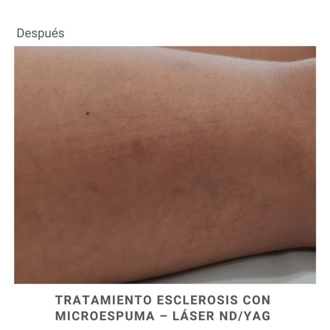 Congreso médico varices