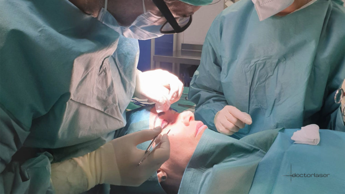 Blefaroplastia resultado