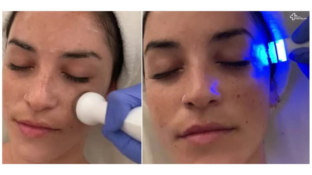 Tratamiento facial Aquapure en clínica estética